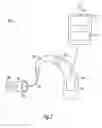 Fig. 03 - System for detection of special environments for hearing assistance devices