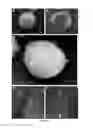 Fig. 03 - Method of treating food allergies by administering a nanoparticle comprising heparin and chitosan encapsulating IL-12