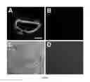 Fig. 08 - Method of treating food allergies by administering a nanoparticle comprising heparin and chitosan encapsulating IL-12