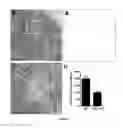 Fig. 10 - Method of treating food allergies by administering a nanoparticle comprising heparin and chitosan encapsulating IL-12
