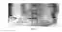 Fig. 12 - Method of treating food allergies by administering a nanoparticle comprising heparin and chitosan encapsulating IL-12