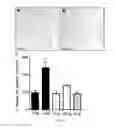 Fig. 13 - Method of treating food allergies by administering a nanoparticle comprising heparin and chitosan encapsulating IL-12