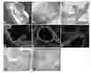 Fig. 01 - GENERATION OF EPITHELIAL CELLS AND ORGAN TISSUE IN VIVO BY REPROGRAMMING AND USES THEREOF