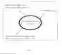 Fig. 02 - PHASED DOSING OF CLOPIDOGREL