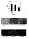 Fig. 09 - Multi-phased, biodegradable and oesteointegrative composite scaffold for biological fixation of musculoskeletal soft tissue to bone