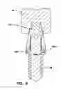 Fig. 06 - Method for making bone implants with interlocking and centering threads