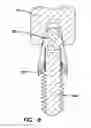 Fig. 08 - Method for making bone implants with interlocking and centering threads