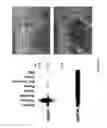 Fig. 02 - Methods of Identifying Modulators of Dephosphorylation of Histone Deacetylase