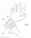 Fig. 04 - Formulation and method of use of a treatment for shingles pain