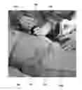 Fig. 01 - Method for obtaining sterile human amniotic fluid and uses thereof