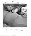 Fig. 02 - Method for obtaining sterile human amniotic fluid and uses thereof