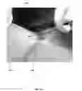 Fig. 03 - Method for obtaining sterile human amniotic fluid and uses thereof