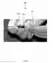 Fig. 04 - Method for obtaining sterile human amniotic fluid and uses thereof