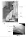 Fig. 05 - Method for obtaining sterile human amniotic fluid and uses thereof