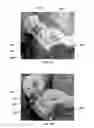 Fig. 06 - Method for obtaining sterile human amniotic fluid and uses thereof