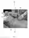 Fig. 08 - Method for obtaining sterile human amniotic fluid and uses thereof