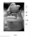 Fig. 09 - Method for obtaining sterile human amniotic fluid and uses thereof