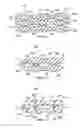Fig. 07 - Dressings, systems, and methods for treating a tissue site