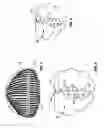 Fig. 02 - METHODS AND APPARATUSES FOR TREATMENT OF MEIBOMIAN GLAND DYSFUNCTION