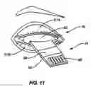 Fig. 10 - METHODS AND APPARATUSES FOR TREATMENT OF MEIBOMIAN GLAND DYSFUNCTION