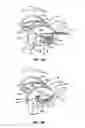 Fig. 12 - METHODS AND APPARATUSES FOR TREATMENT OF MEIBOMIAN GLAND DYSFUNCTION