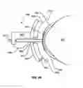 Fig. 29 - METHODS AND APPARATUSES FOR TREATMENT OF MEIBOMIAN GLAND DYSFUNCTION