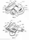Fig. 33 - METHODS AND APPARATUSES FOR TREATMENT OF MEIBOMIAN GLAND DYSFUNCTION