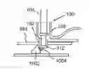 Fig. 01 - Apparatus for performing vascular anastomosis