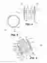 Fig. 03 - Apparatus for performing vascular anastomosis