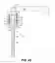 Fig. 37 - Apparatus for performing vascular anastomosis