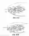 Fig. 53 - Apparatus for performing vascular anastomosis