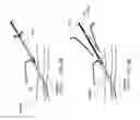 Fig. 07 - BALLOON FOR IABP BALLOON CATHETER