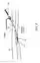 Fig. 08 - BALLOON FOR IABP BALLOON CATHETER