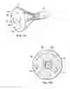 Fig. 05 - Stent delivery under direct visualization