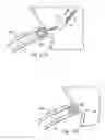 Fig. 12 - Stent delivery under direct visualization