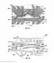 Fig. 09 - Transforaminal prosthetic spinal disc apparatus