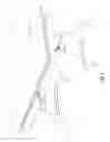 Fig. 02 - Table