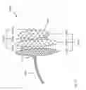 Fig. 47 - LASER CUTTING SYSTEMS