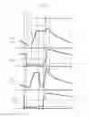 Fig. 07 - Method for controlling neck detection for welding power supply