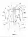 Fig. 02 - Ergonomic Back Support Device
