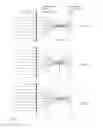 Fig. 02 - Multifocal correction providing improved quality of vision