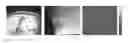 Fig. 01 - Feature-based watermark localization in digital capture systems