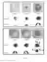Fig. 02 - Methods of Treating Serosal Cancer