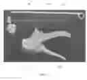 Fig. 02 - IRRIGATION RESISTANT COMPOSITIONS FOR REGENERATION OF HARD TISSUES AND METHODS AND KITS OF USING THE SAME