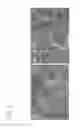 Fig. 06 - Handheld Device for Delivering Photodynamic Therapy
