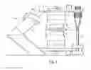 Fig. 02 - Method and device for the determination of the centric position of a human set of teeth
