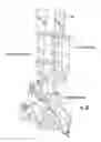 Fig. 40 - Surgical navigation devices and methods