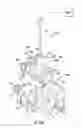 Fig. 46 - Surgical navigation devices and methods