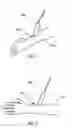 Fig. 02 - Depth Advancement Marker Needle For Image Guided Procedures