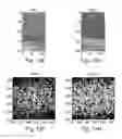 Fig. 11 - Method and apparatus for tissue disease diagnosis
